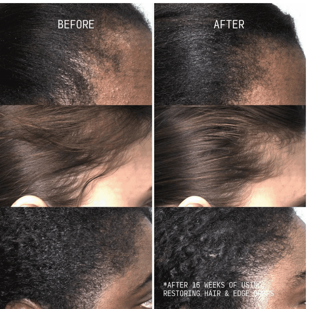 Cecred Restoring Hair & Edge Drops - HypeFly India View 4