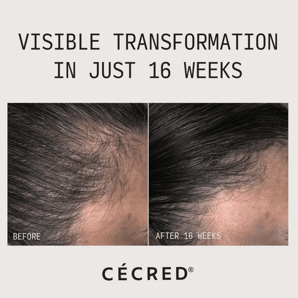 Cecred Restoring Hair & Edge Drops - HypeFly India View 2