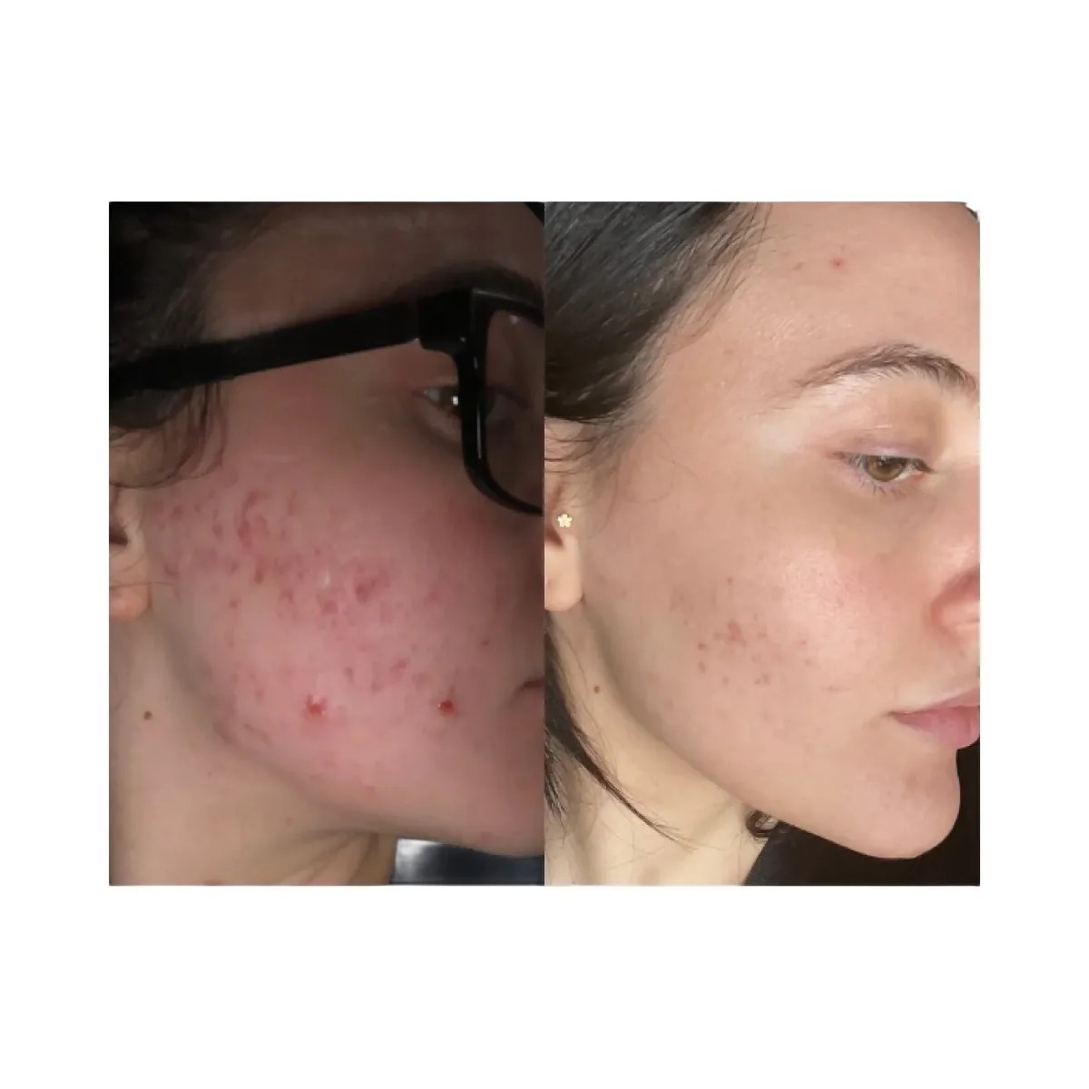 Summer Fridays CC Me Vitamin C + Niacinamide Serum - HypeFly India View 4