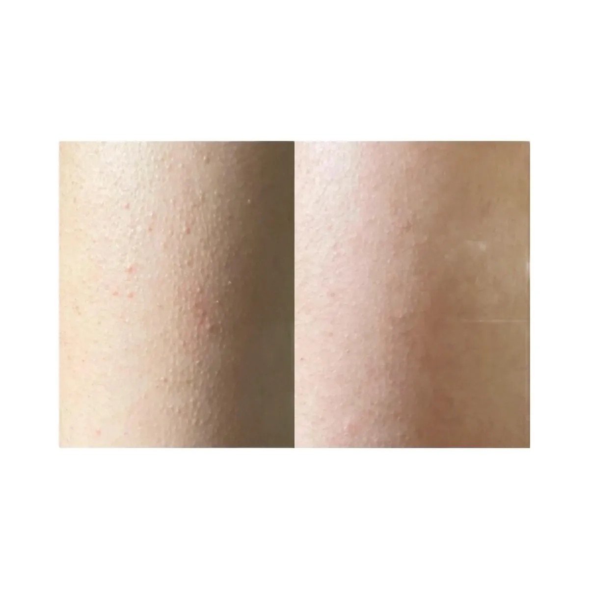 INKEY Glycolic Acid Exfoliating Body Stick - HypeFly India View 5