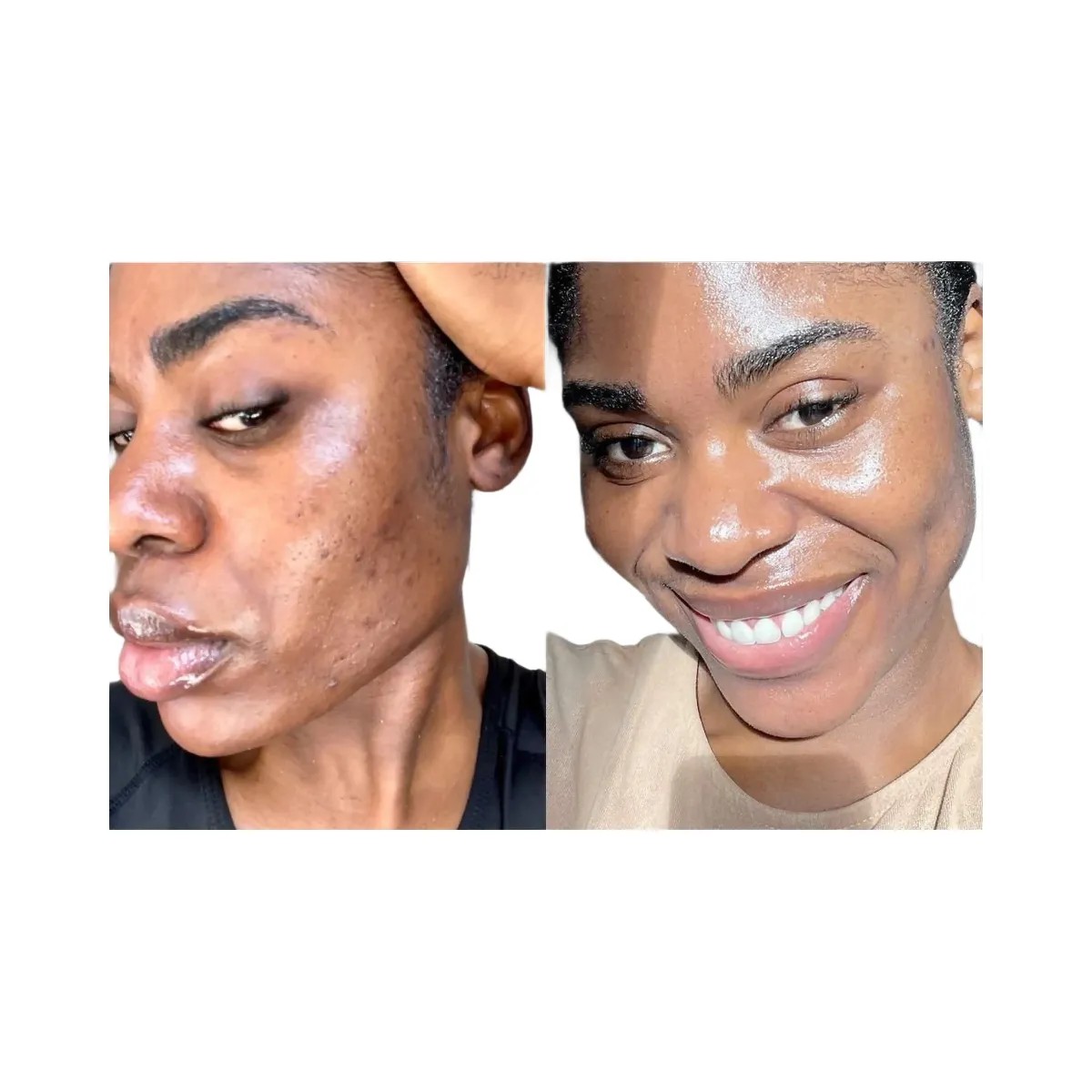 INKEY Omega Water Cream Oil-Free Moisturizer - HypeFly India View 3