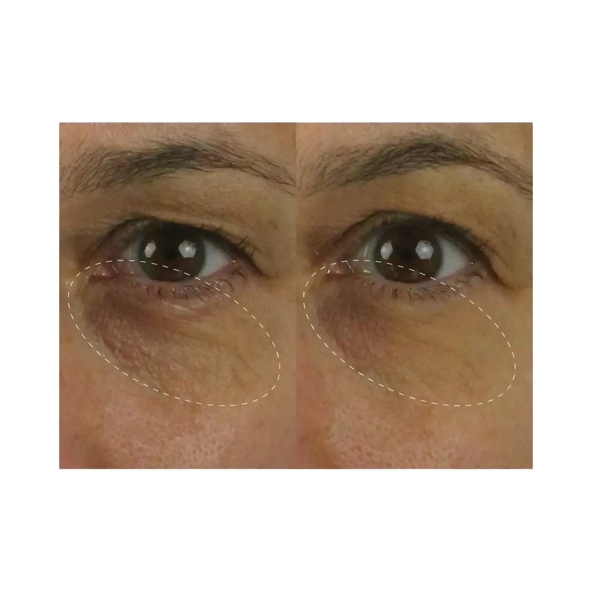 TATCHA The Brightening Eye Cream - HypeFly India View 2