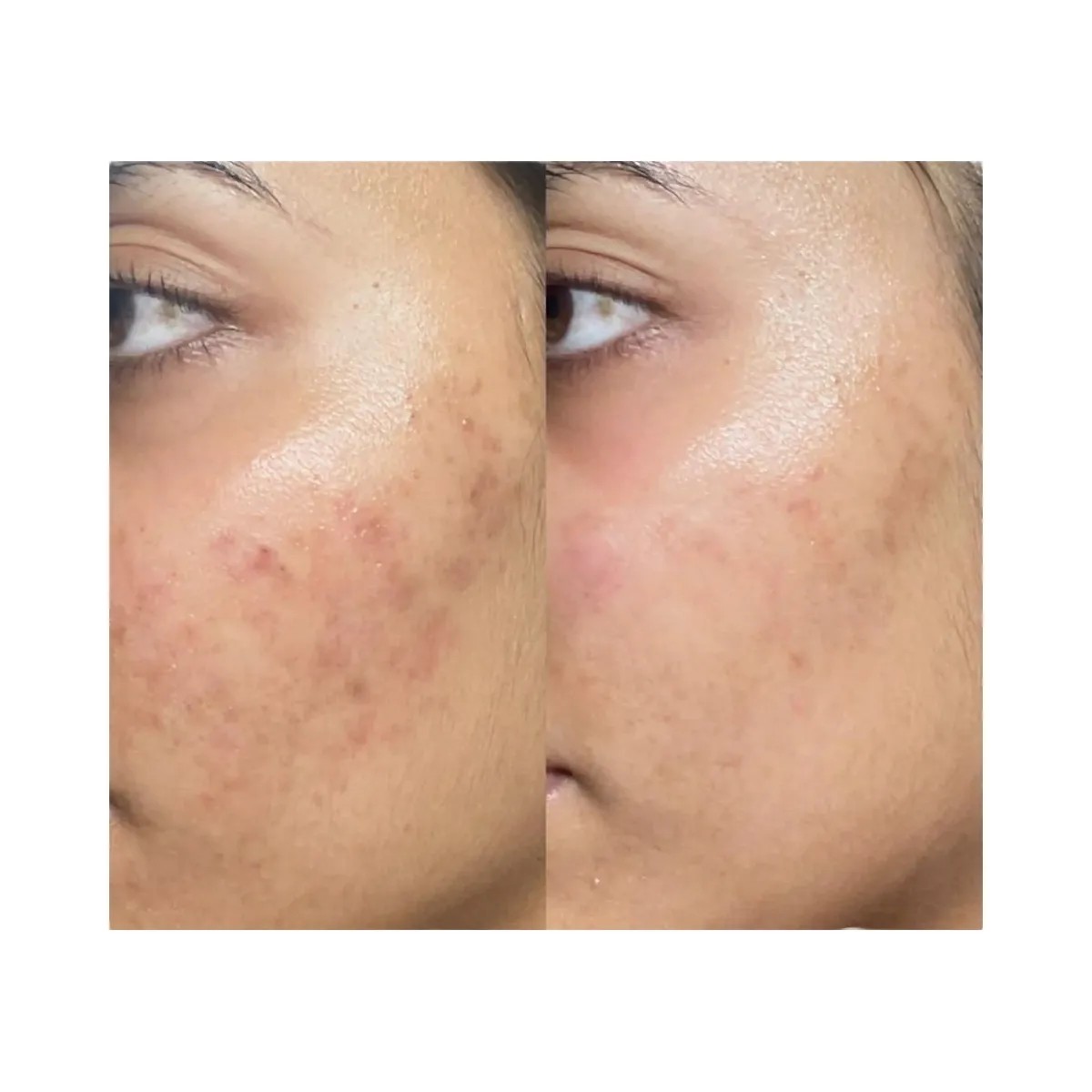 INKEY Ectoin Hydro-Barrier Serum - HypeFly India View 5