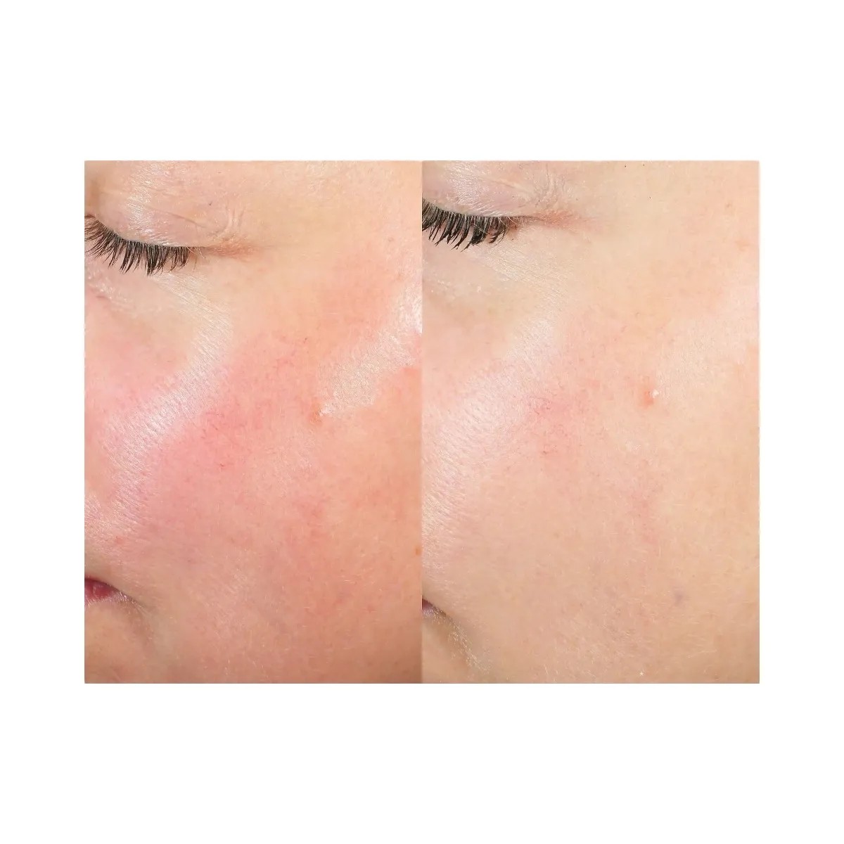 Summer Fridays Midnight Ritual Retinol Renewal Serum - HypeFly India View 4