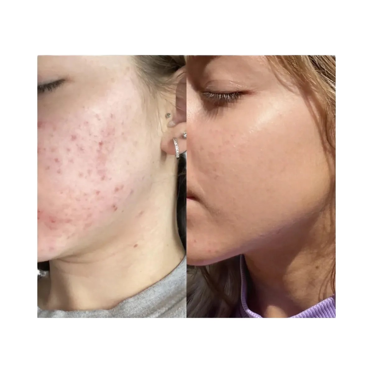 INKEY Niacinamide Oil Control Serum - HypeFly India View 3