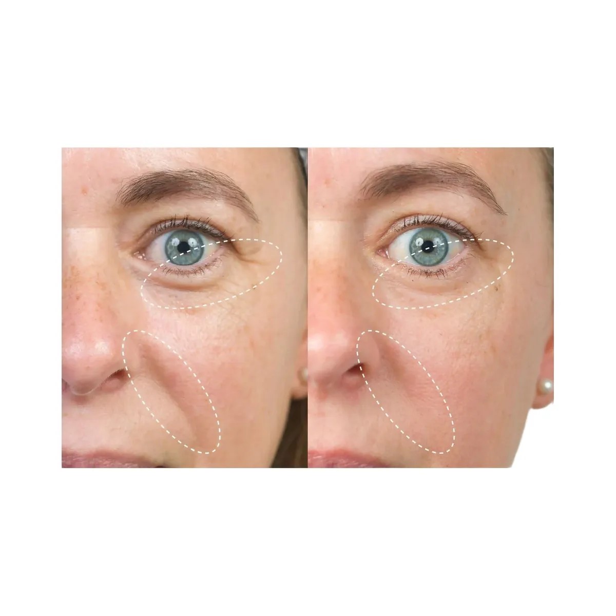 INKEY Bio-Active Ceramide Repairing and Plumping Moisturizer - HypeFly India View 5