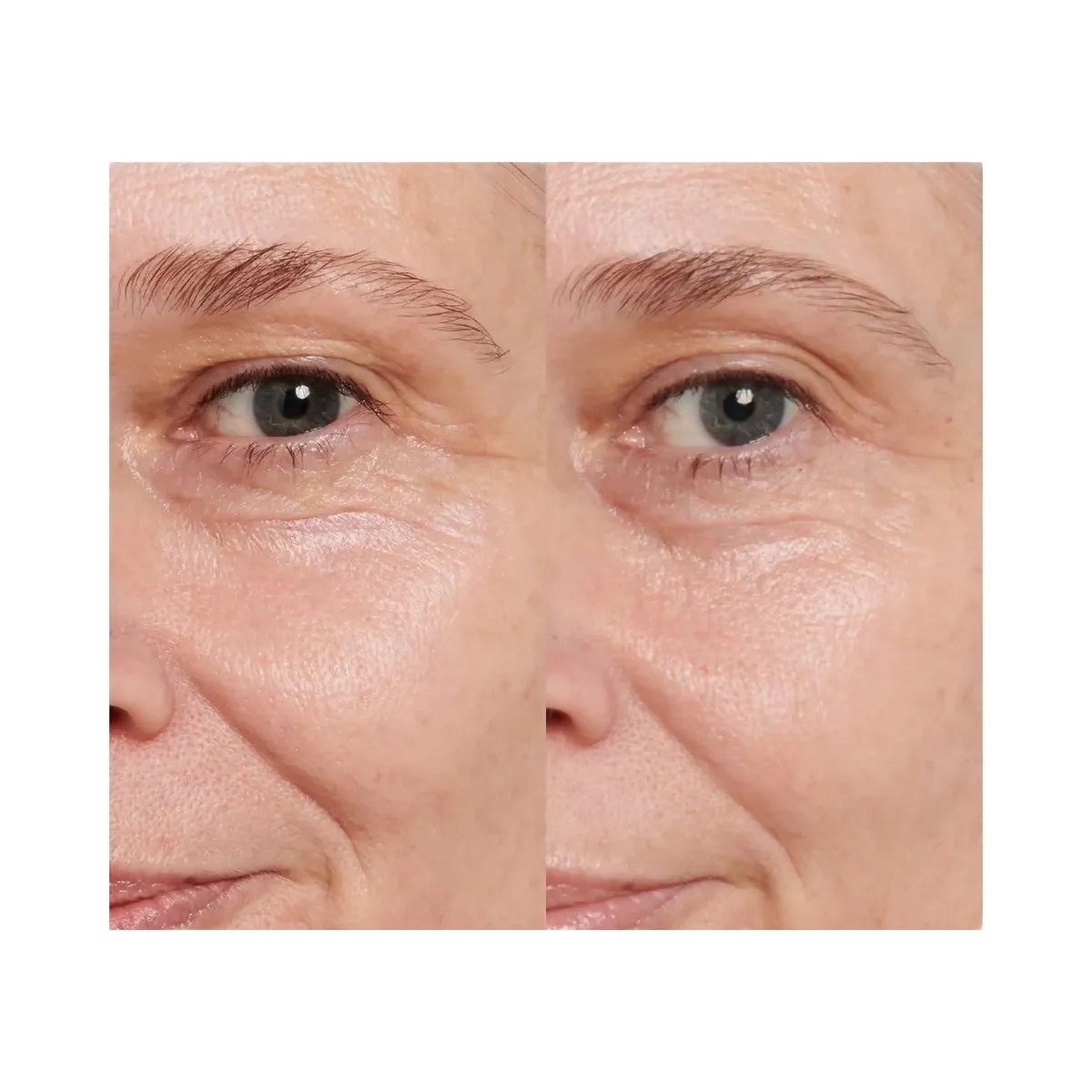 INKEY Retinol Eye Cream - HypeFly India View 3