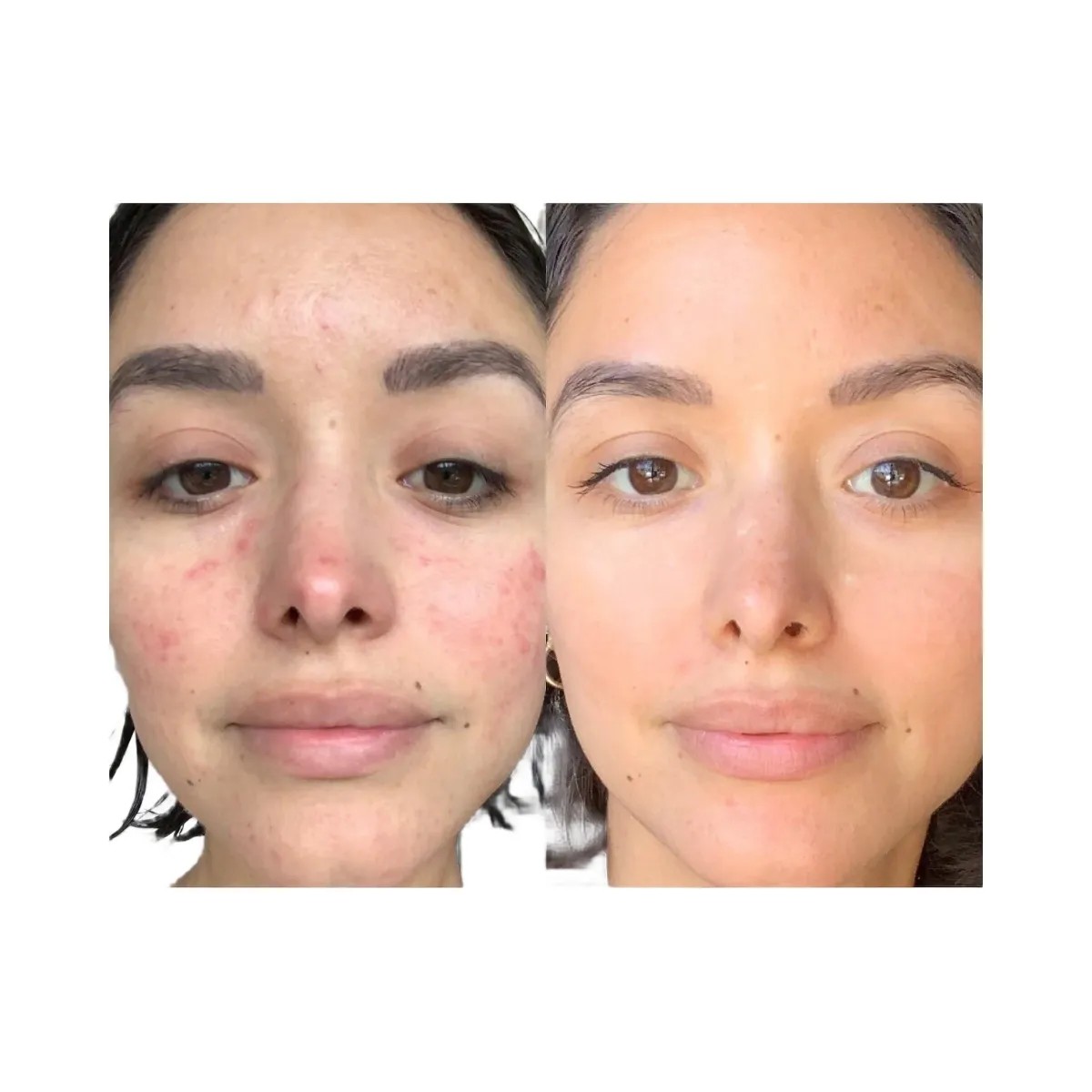 Summer Fridays CC Me Vitamin C + Niacinamide Serum - HypeFly India View 3