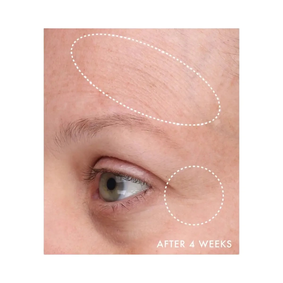 Summer Fridays Gentle Reset Daily Exfoliating Pads to Smooth + Minimize Pores with AHAs - HypeFly India View 4