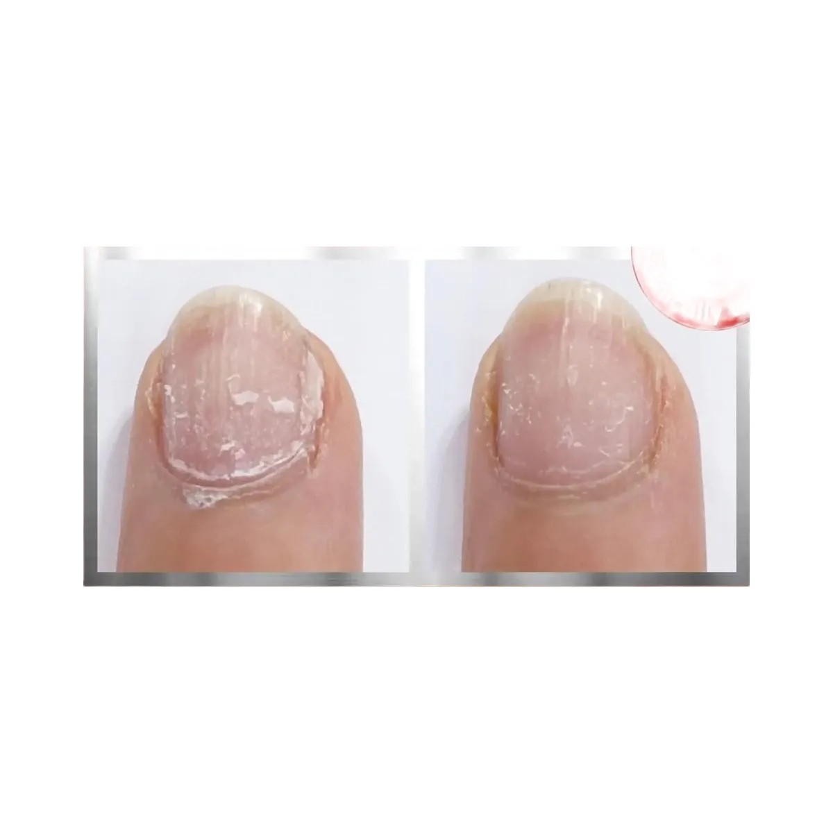 Essie To The Rescue UV Gel Damage Repair - HypeFly India View 3