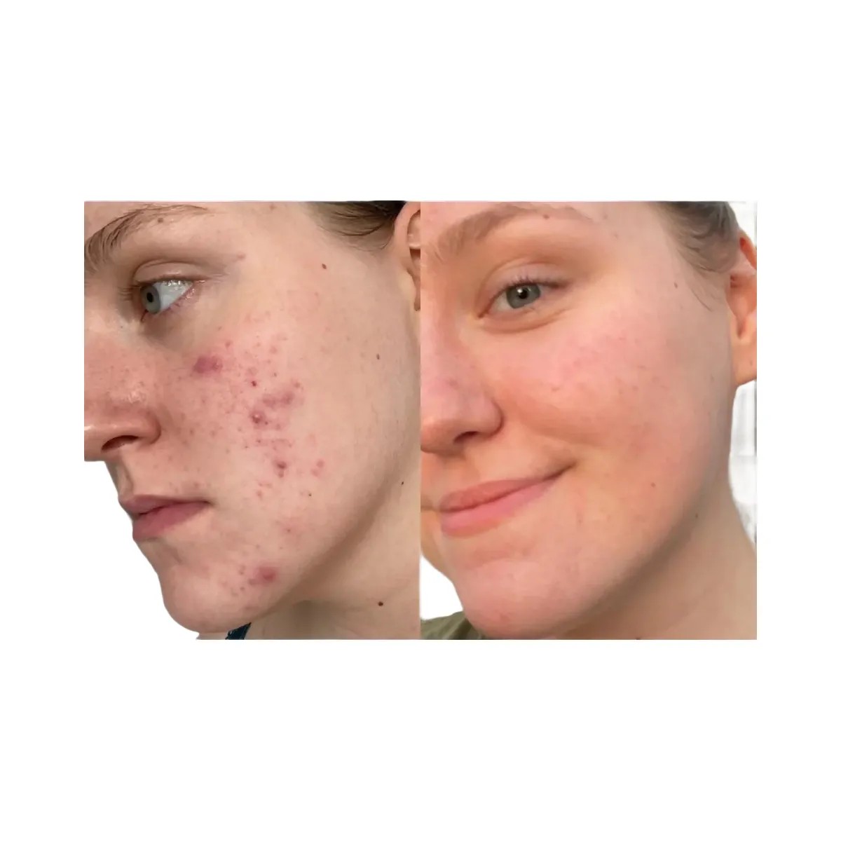 INKEY 15% Vitamin C & EGF Brightening Serum - HypeFly India View 3