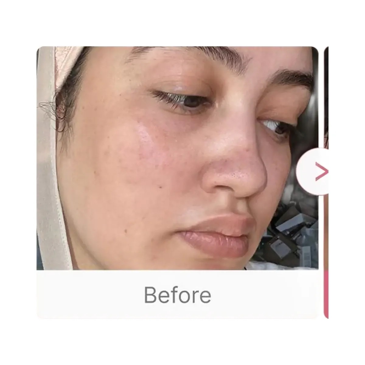 medicube Collagen Milk Toning Wrapping Mask - HypeFly India View 5