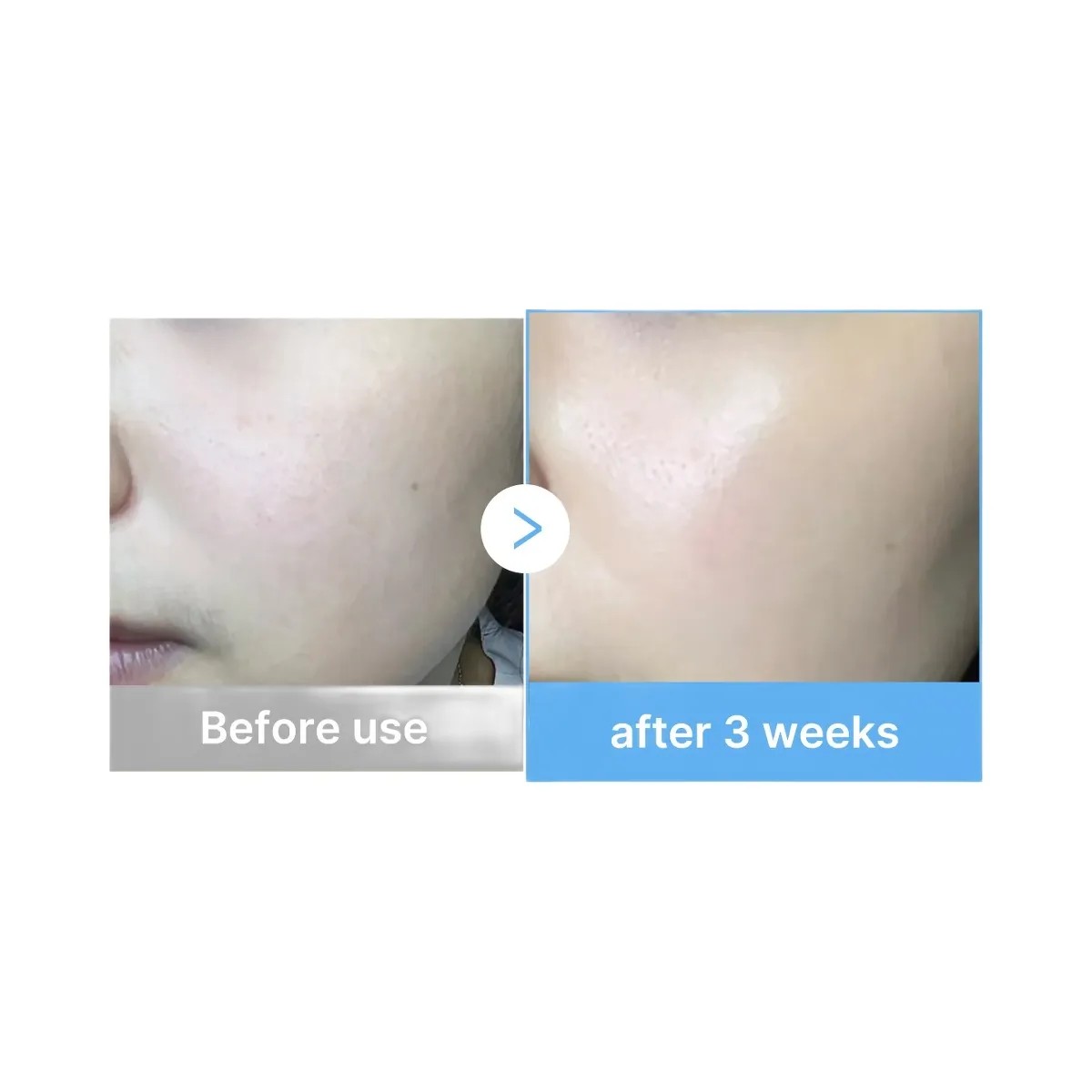 Medicube Hyaluronic Multi Peptide PDRN Serum - HypeFly India View 4