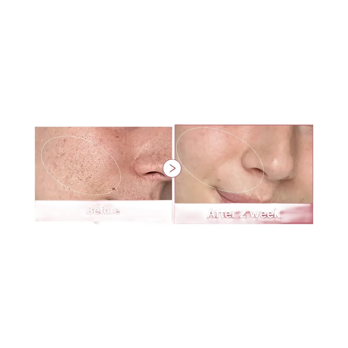 Medicube PDRN Pink Peptide Toner - HypeFly India View 2