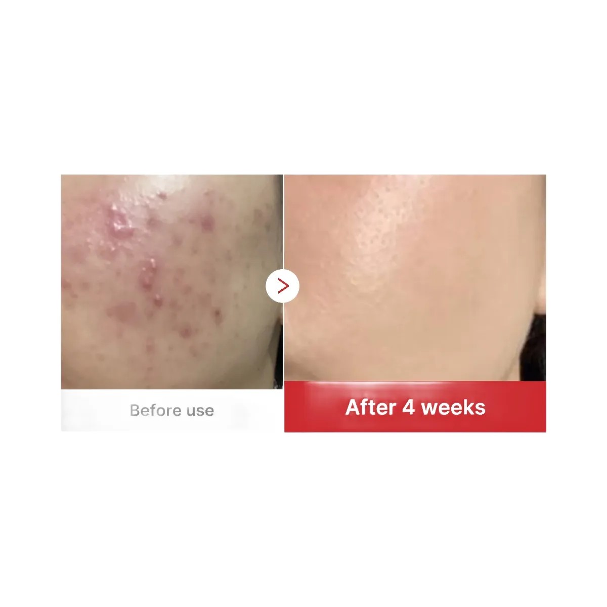 Medicube Red Succinic Acid Panthenol Pads - HypeFly India View 4