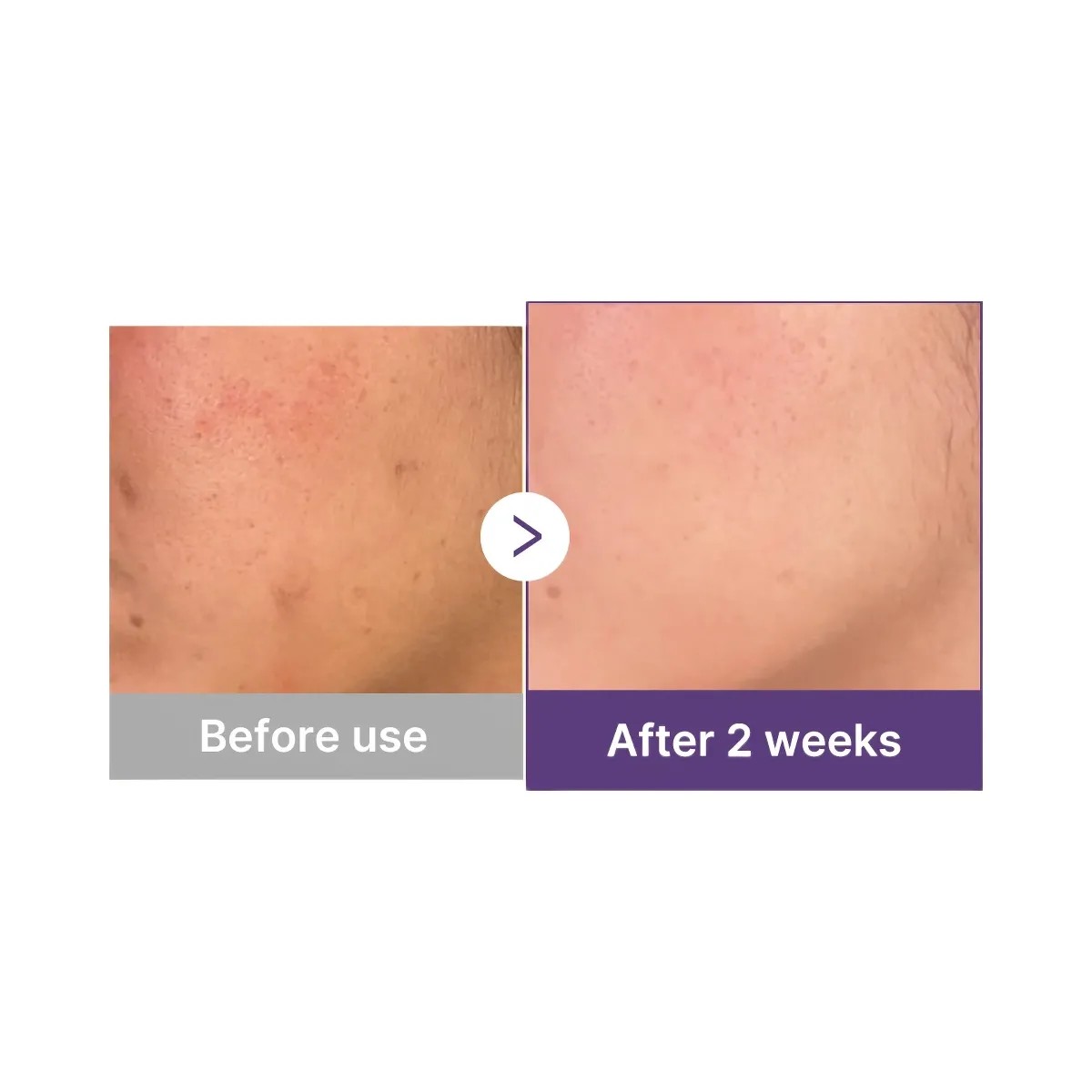 Medicube Retinol NMN Boosting Serum - HypeFly India View 4