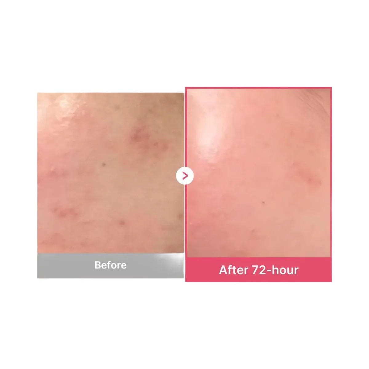 medicube TXA Niacinamide 15% Serum - HypeFly India View 5