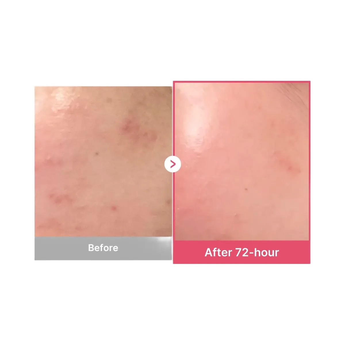 Medicube TXA Niacinamide Serum - HypeFly India View 3