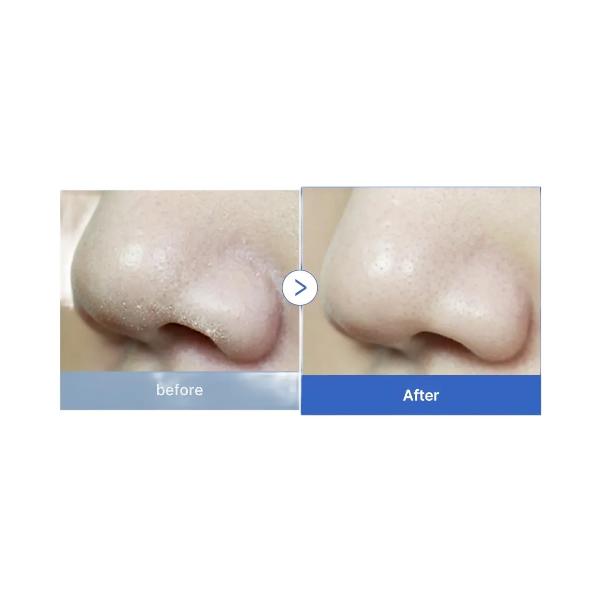 Medicube Zero Foam Cleanser - HypeFly India View 3