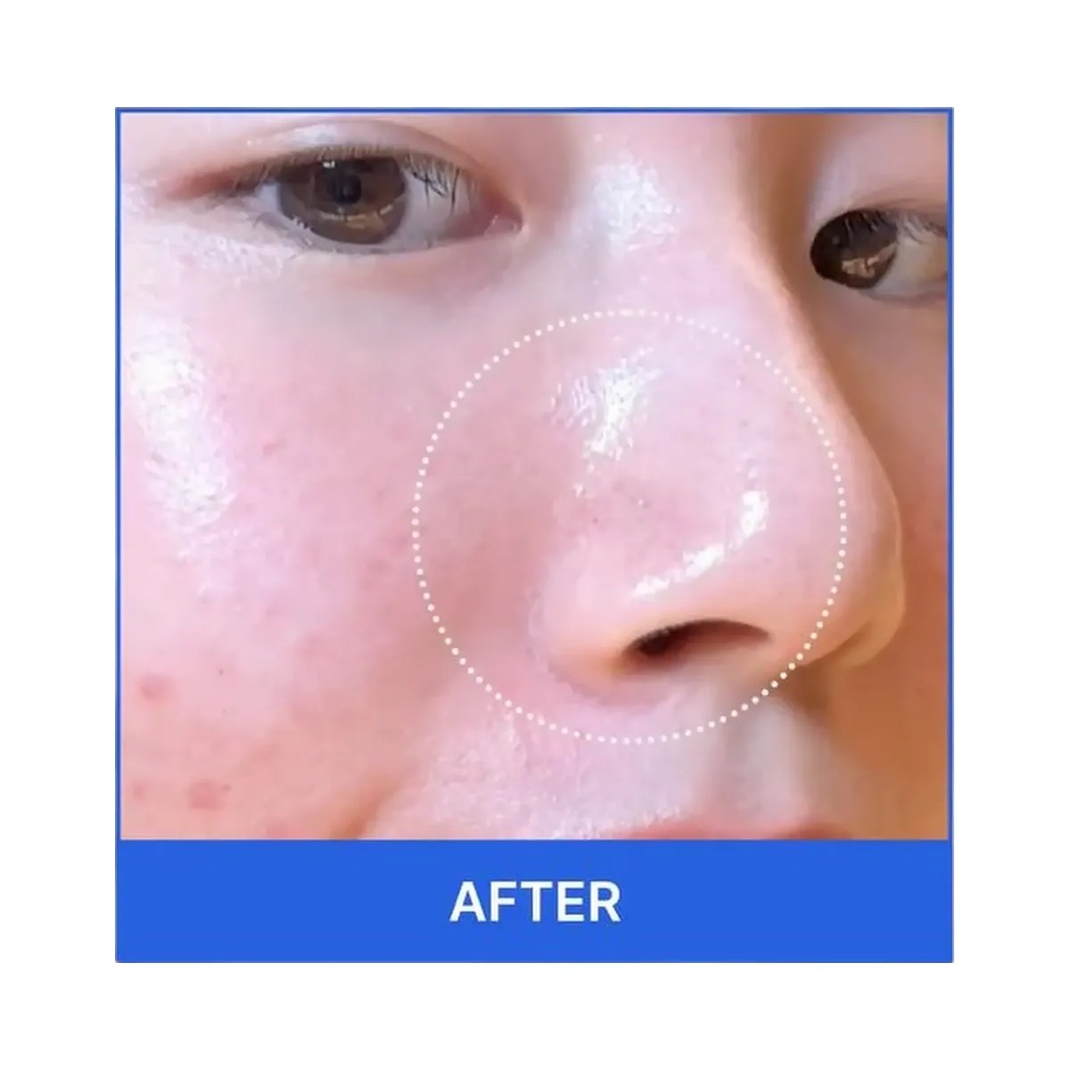 medicube Zero Pore Pad - HypeFly India View 6