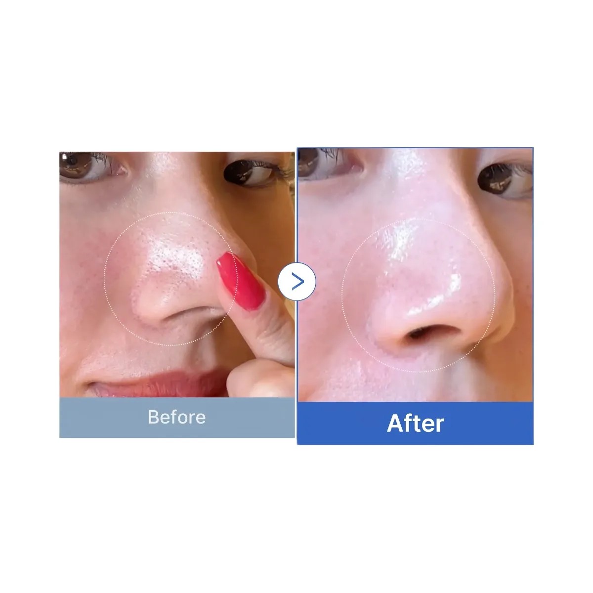 Medicube Zero Pore Pads - HypeFly India View 5