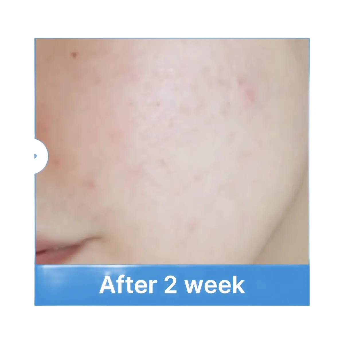 Medicube Zero Pore Toner - HypeFly India View 2