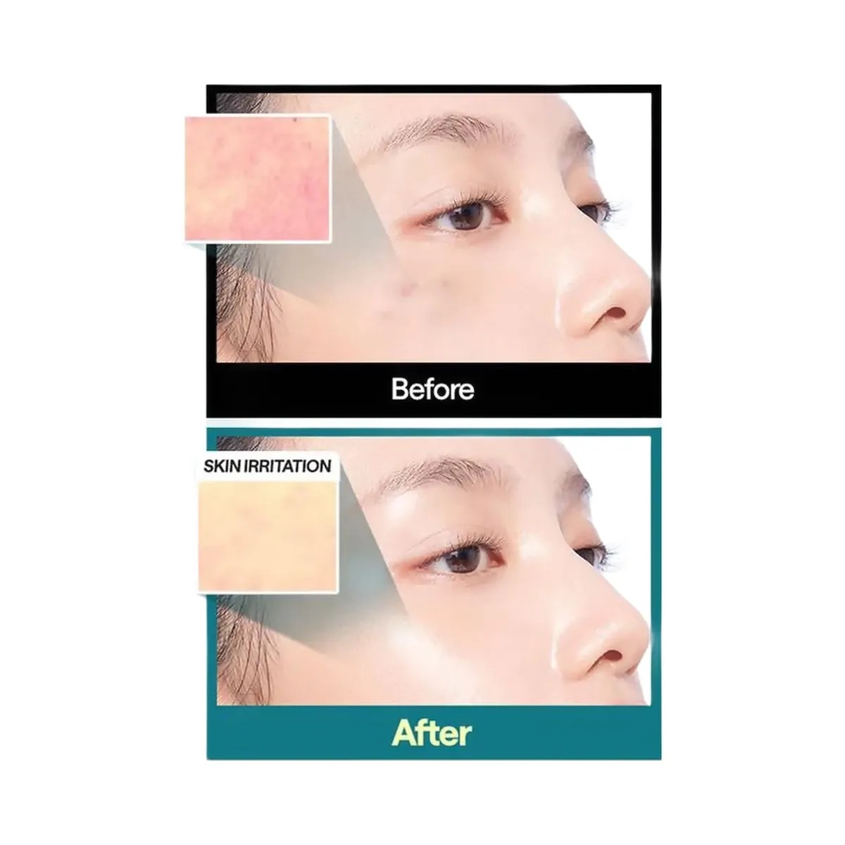 MEDIHEAL Madecassoside Essential Mask - HypeFly India View 5