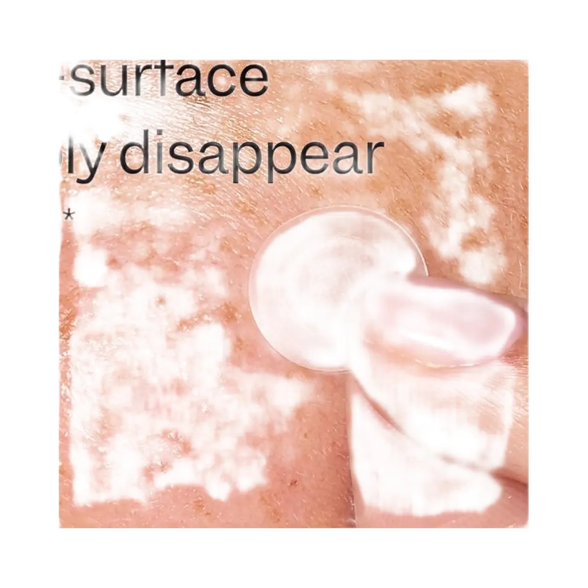 Peach Slices Deep Blemish Microdarts - HypeFly India View 6