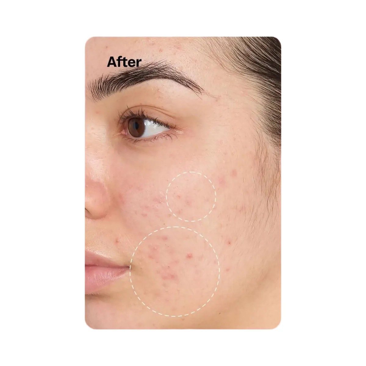 Peach Slices Fix All Recovery Spray - HypeFly India View 3