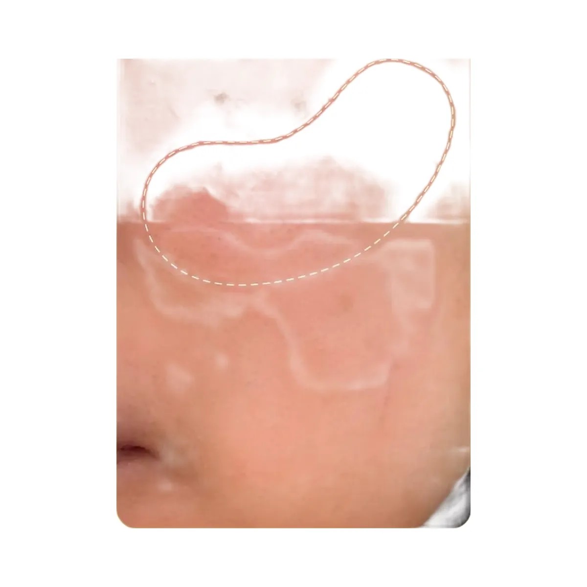Peach Slices Super Fade Discoloration Serum - HypeFly India View 3