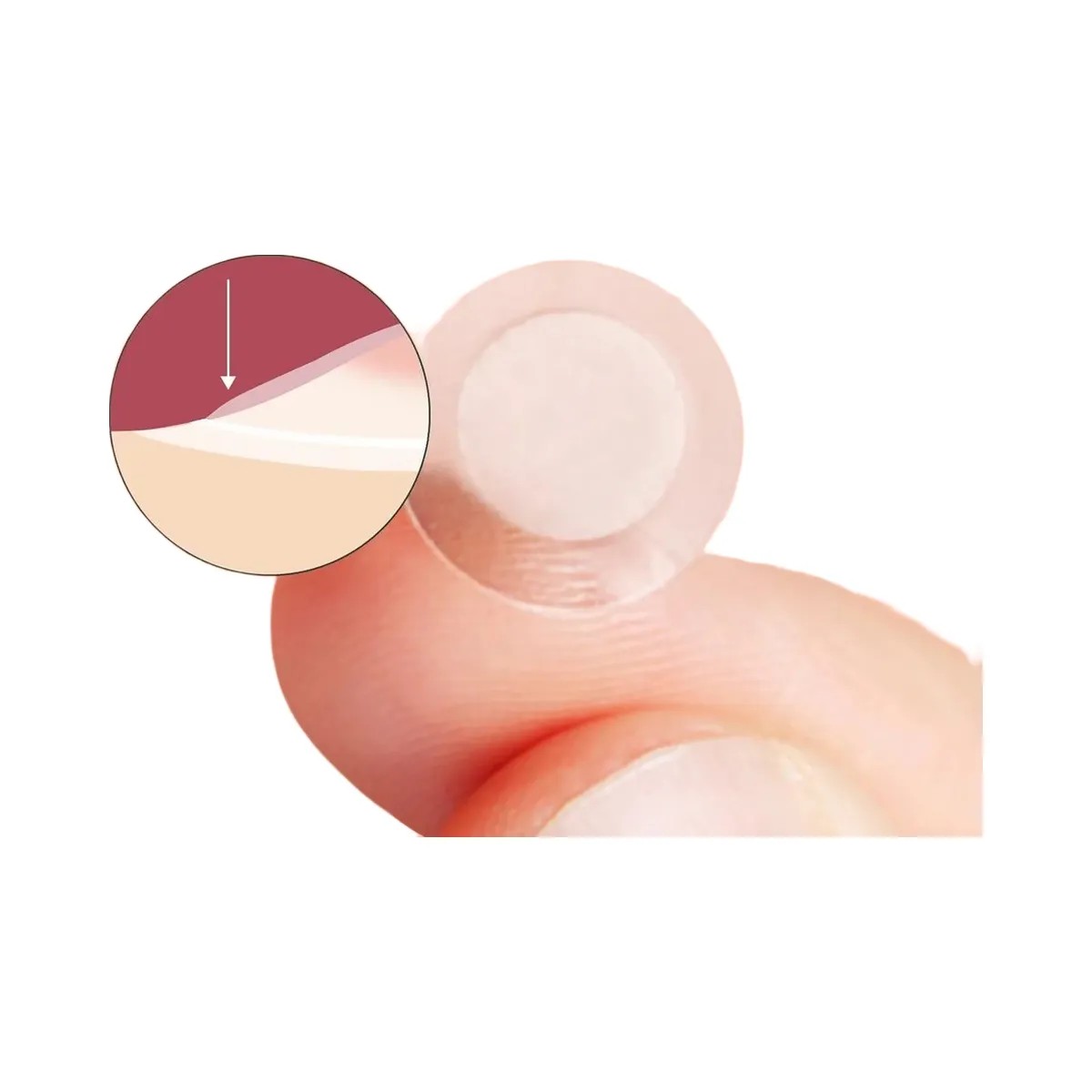 Rael Miracle Patch Invisible Spot Cover - HypeFly India View 2