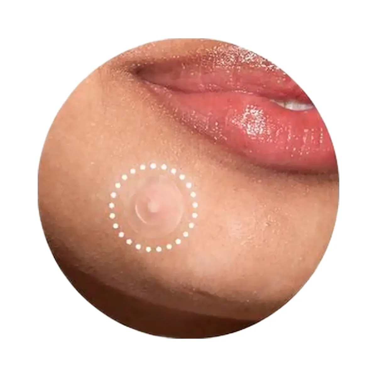 Rael Miracle Patch Invisible Spot Cover - HypeFly India View 6