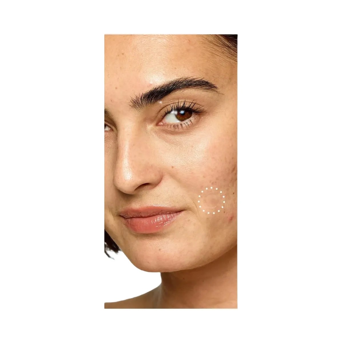 Rael Miracle Patch Retinol Spot Cover - HypeFly India View 5