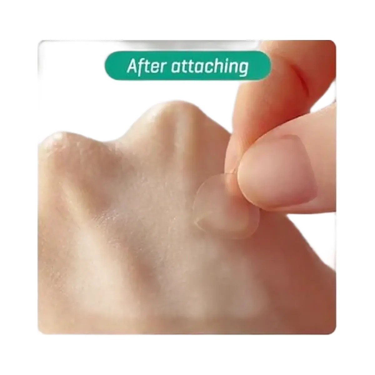 SOME BY MI Clear Spot Patch - HypeFly India View 5