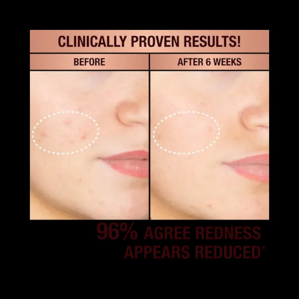 Charlotte Tilbury Dark Spot Correcting Radiance Recovery Serum - HypeFly India View 2