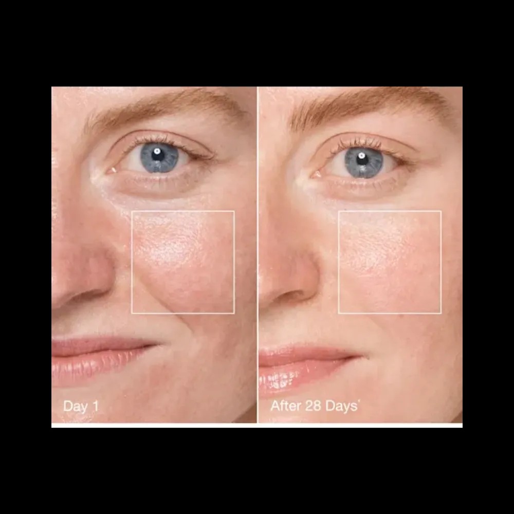 Charlotte Tilbury Magic Cream Forever Skincare Kit - HypeFly India View 2
