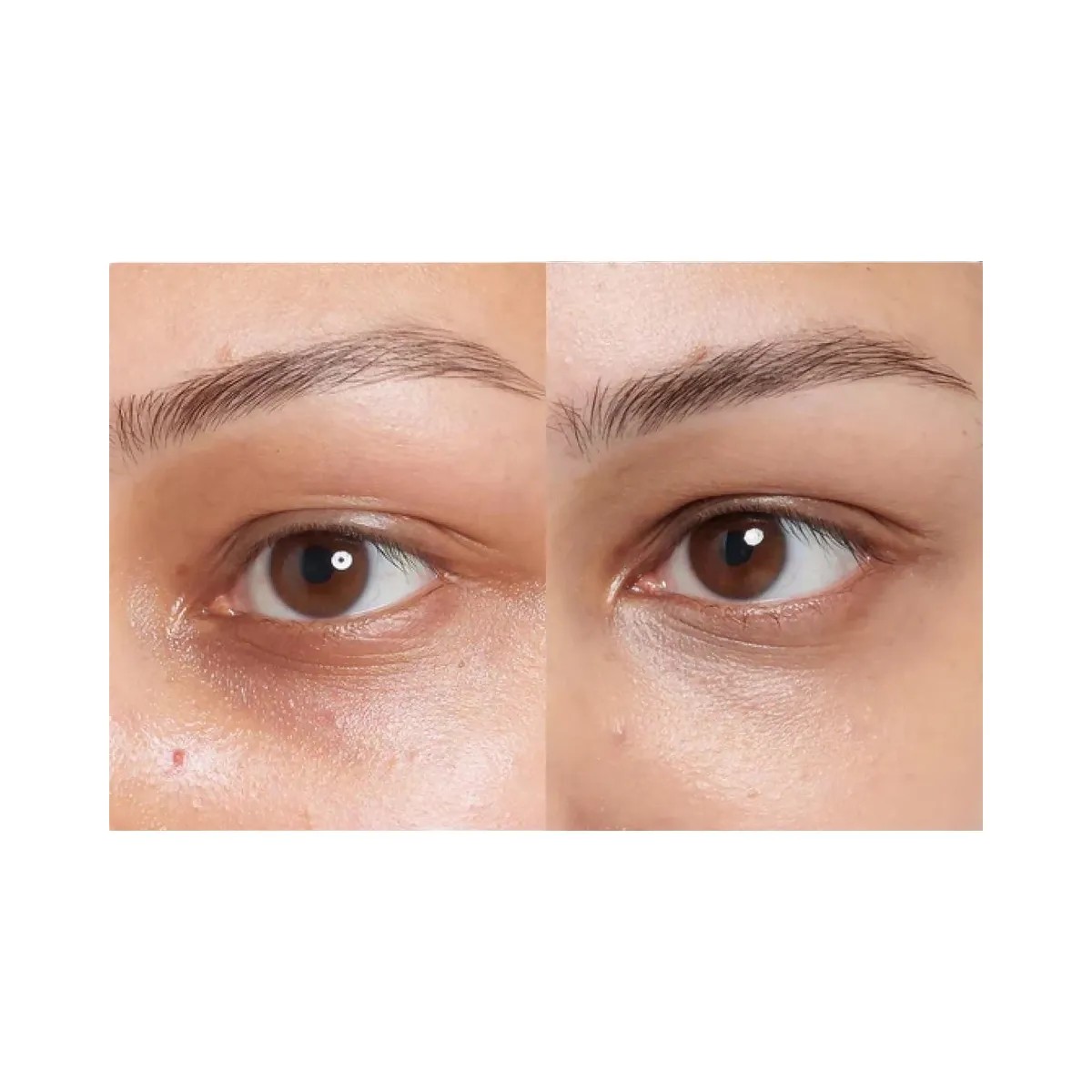 INKEY Caffeine De-puffing + Dark Circle Eye Cream - HypeFly India View 4