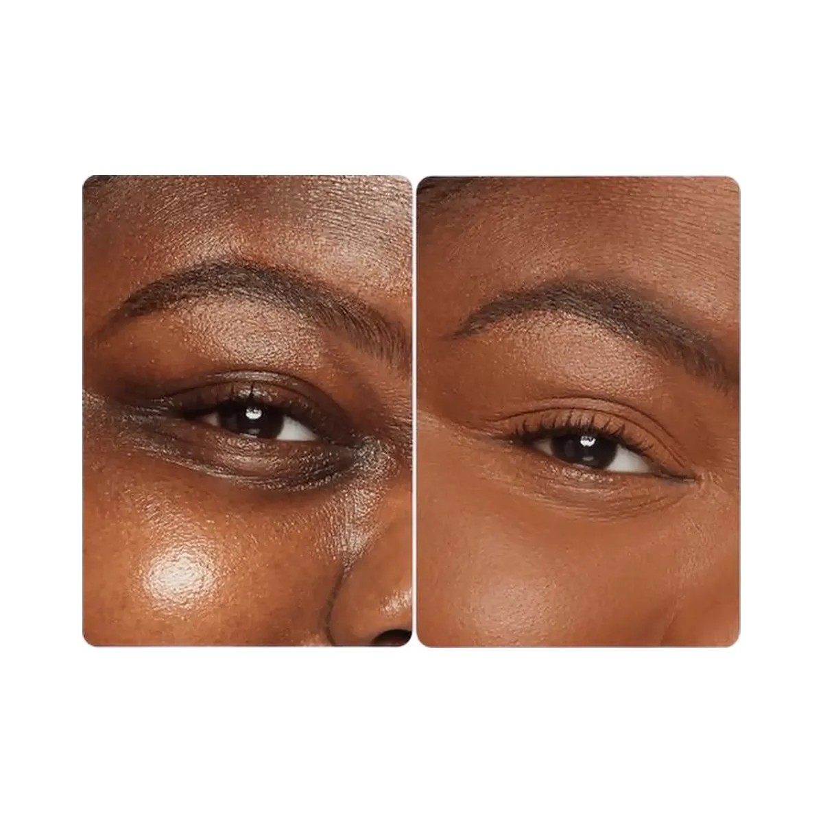 Tarte The Award Winners Best-Sellers Set - Shape Tape Concealer - HypeFly India View 5