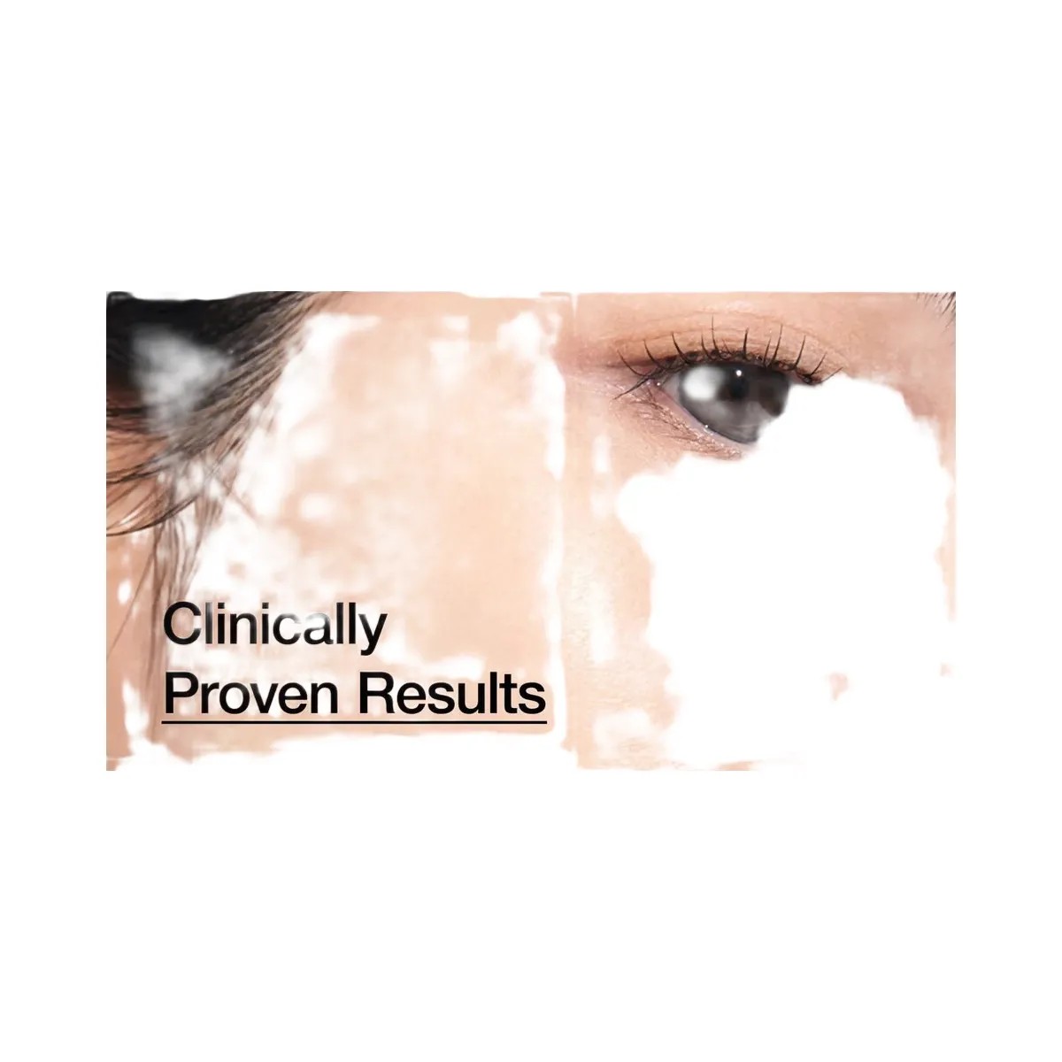 ANUA 7 Rice Ceramide Hydrating Barrier Serum - HypeFly India View 5