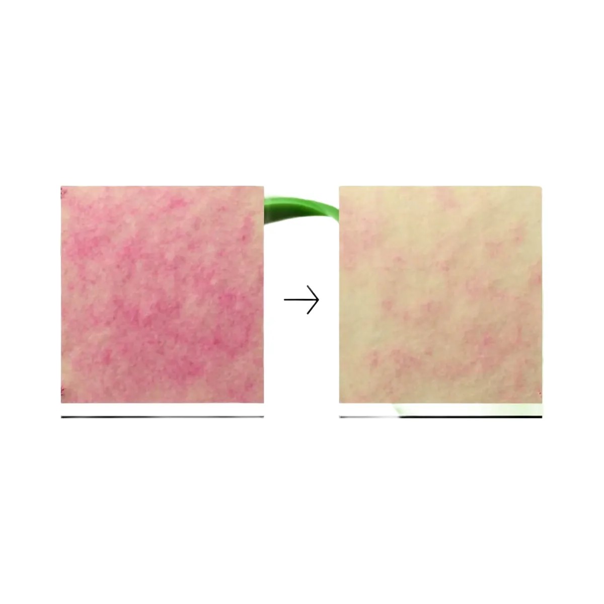 ANUA Azelaic Acid 10 Hyaluron Redness Soothing Pad - HypeFly India View 4