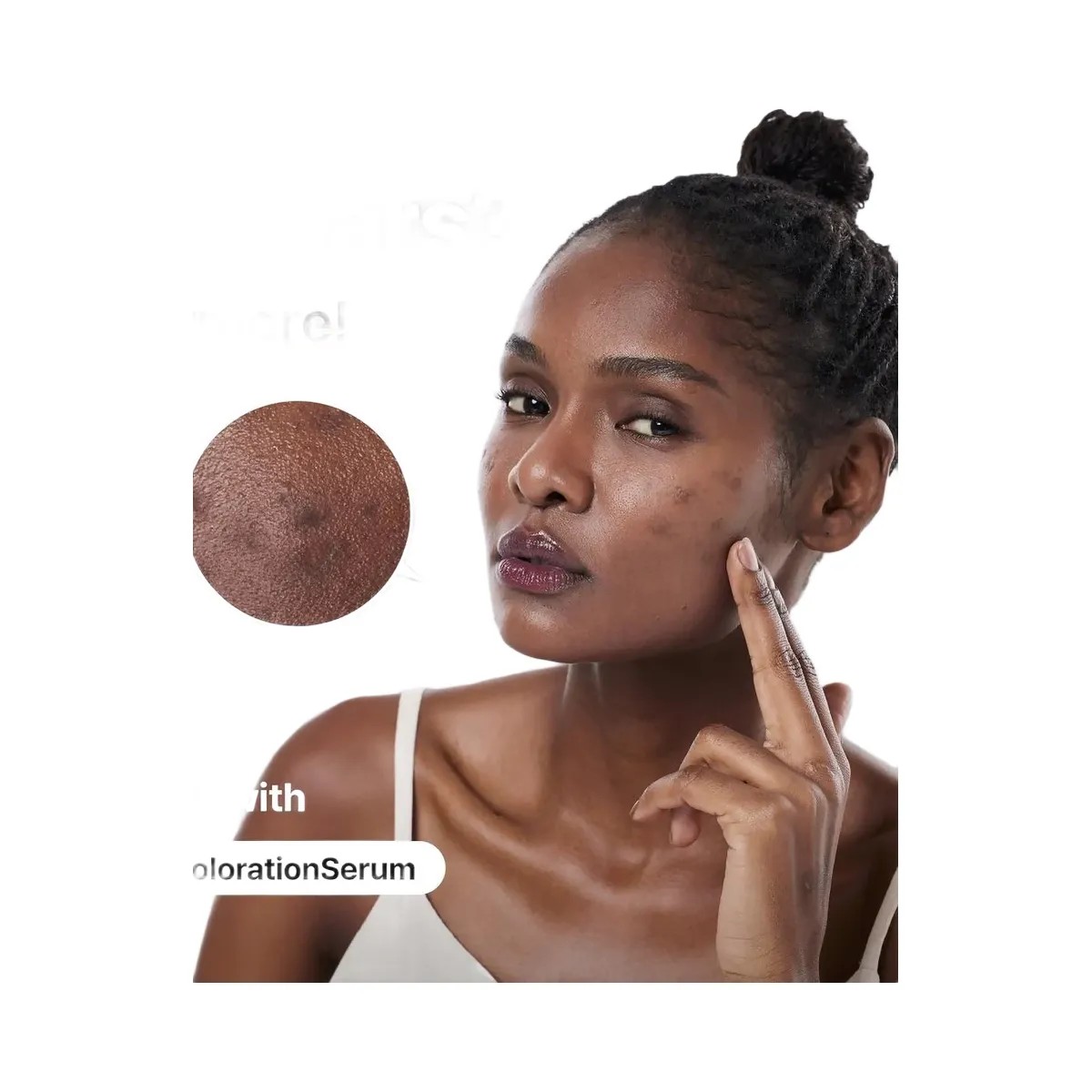 COSRX The Alpha-Arbutin 2 Discoloration Care Serum - HypeFly India View 2