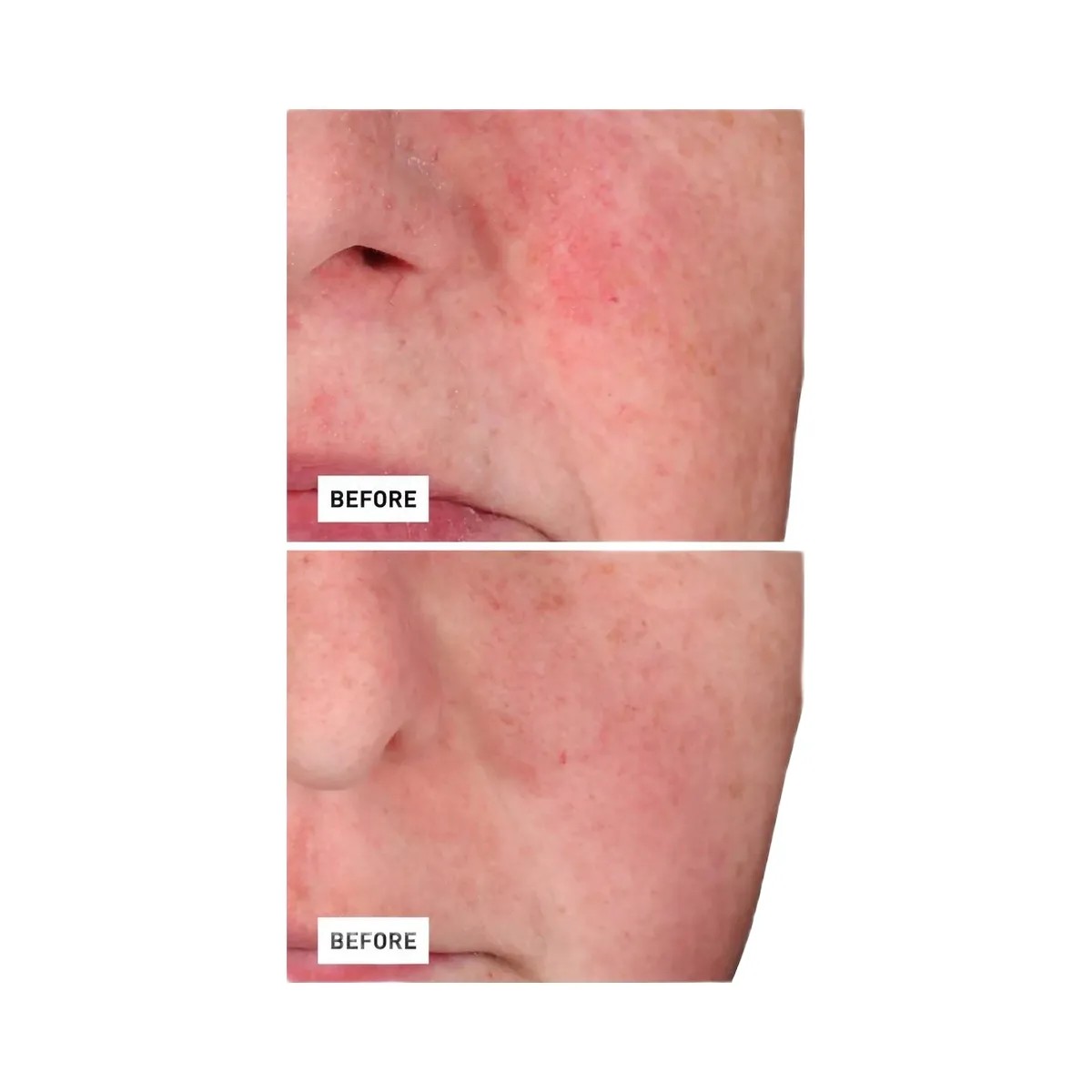 Erborian Centella Red Serum with Korean Centella Asiatica Extract - HypeFly India View 5