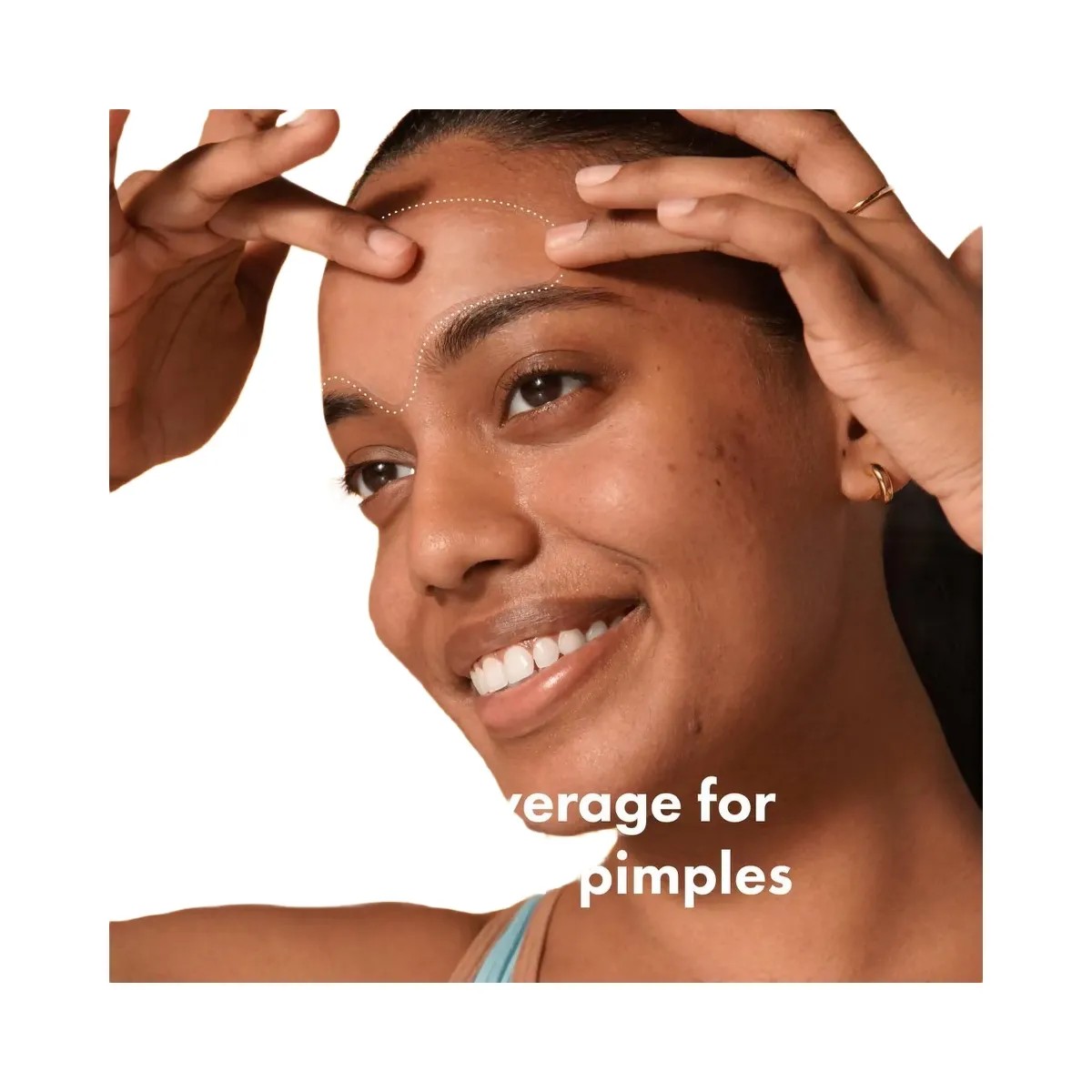 Hero Cosmetics Mighty Patch Forehead Pimple Patches - HypeFly India View 3