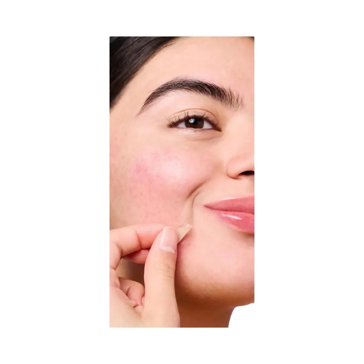 Hero Cosmetics Mighty Patch Micropoint for Blemishes Patches - HypeFly India View 3