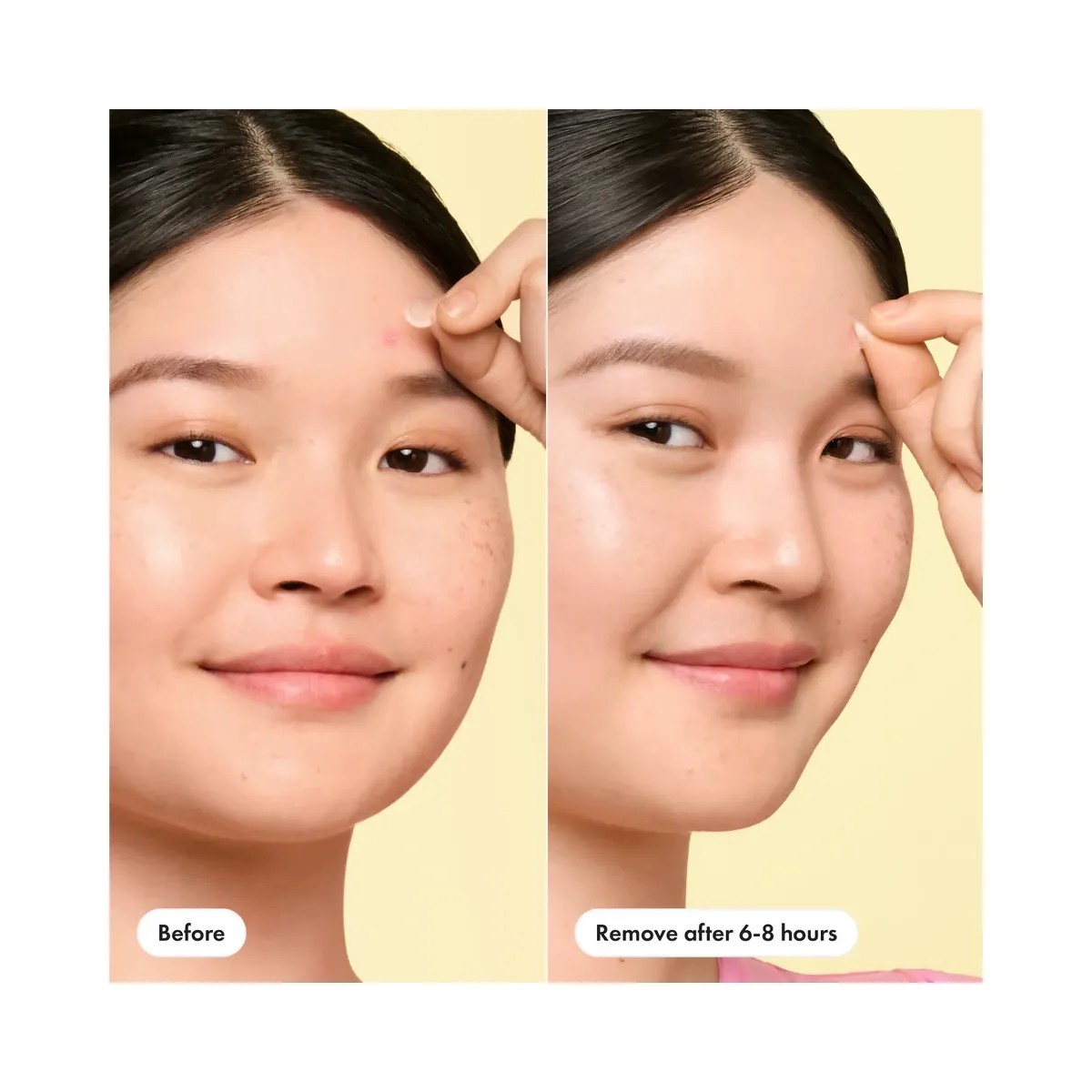 Hero Cosmetics Mighty Patch Mini Invisible+ - HypeFly India View 2