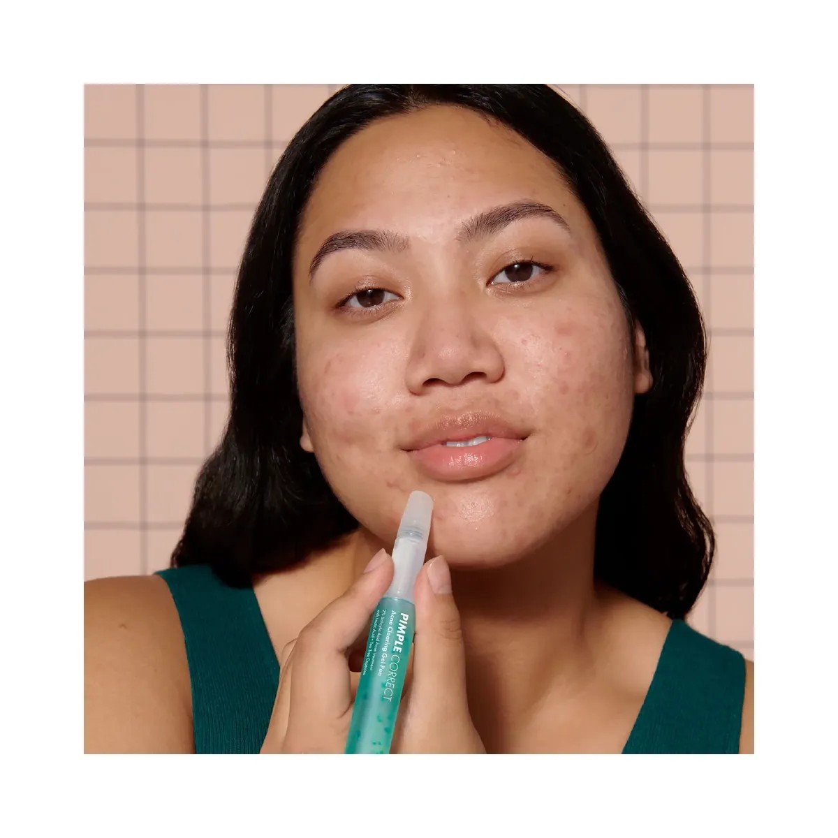 Hero Cosmetics Pimple Correct Acne Clearing Gel Pen - HypeFly India View 5