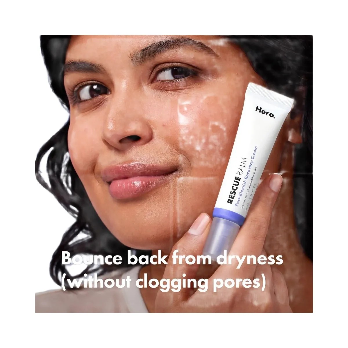 Hero Cosmetics Rescue Balm Post-Blemish Recovery Cream - HypeFly India View 6
