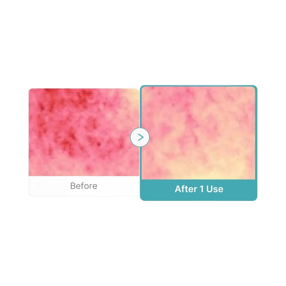 Medicube Azelaic Acid Capsule Foam Cleanser - HypeFly India View 4