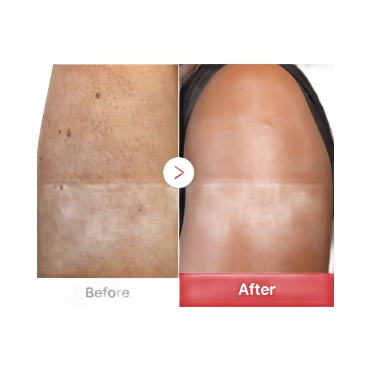 Medicube Hypochlorous Acid Rice Body Peel Shot - HypeFly India View 4