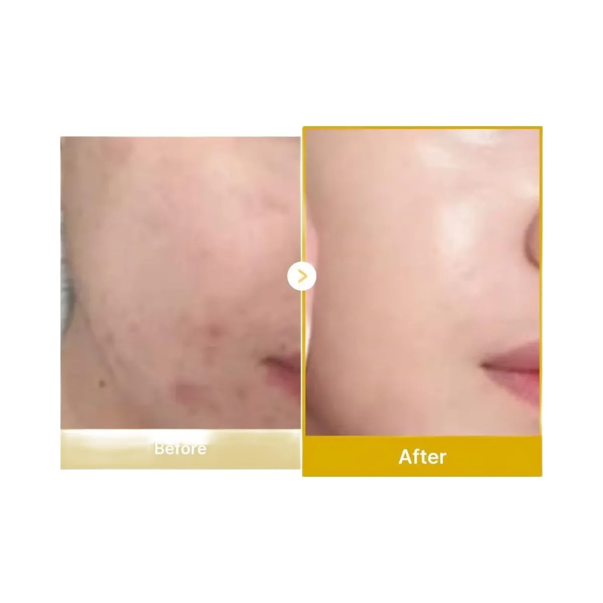medicube Kojic Acid Turmeric Night Wrapping Mask - HypeFly India View 5